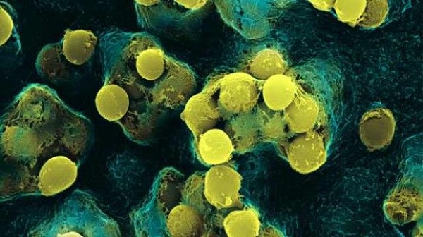 Лактобактерии (Lactobacillus acidophilus) Лактобактерии (Lactobacillus acidophilus)