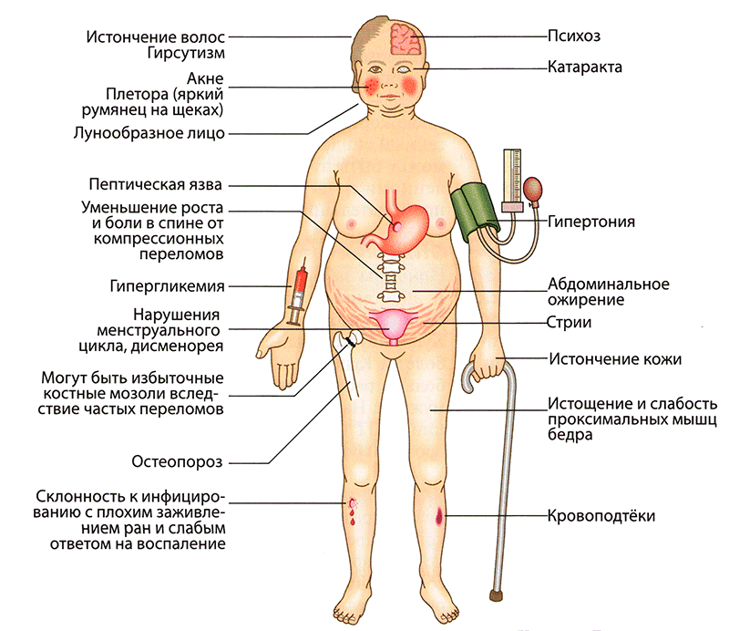 Побочные эффекты лечения глюкокортикоидами