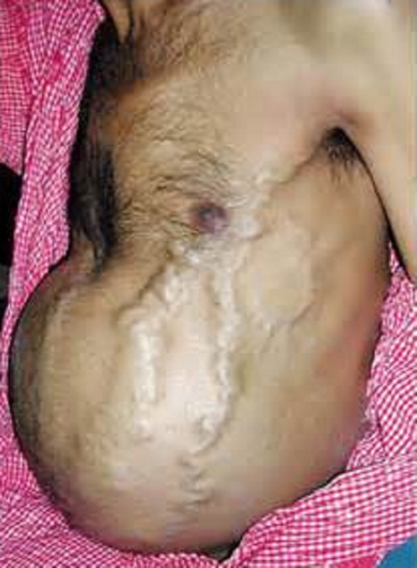 Этиология первичной формы неизвестна