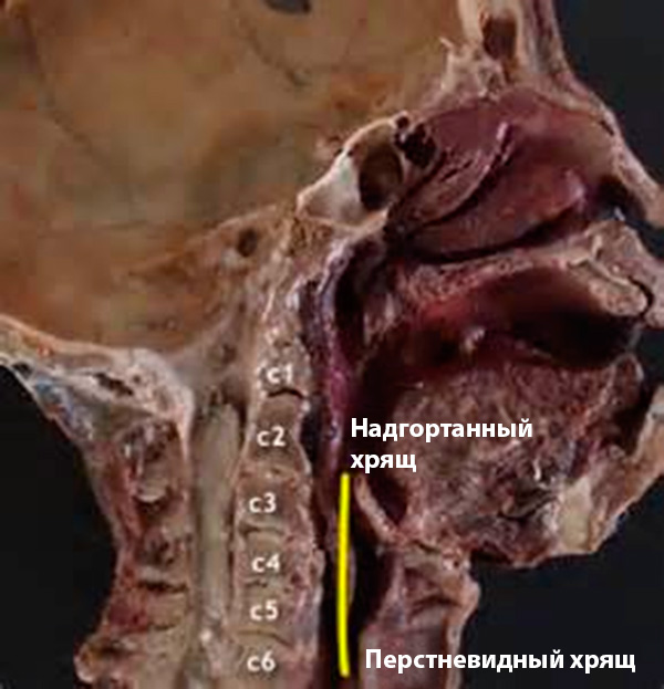 Инородные тела глотки Инородные тела глотки