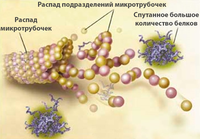 Бактериальный цистит