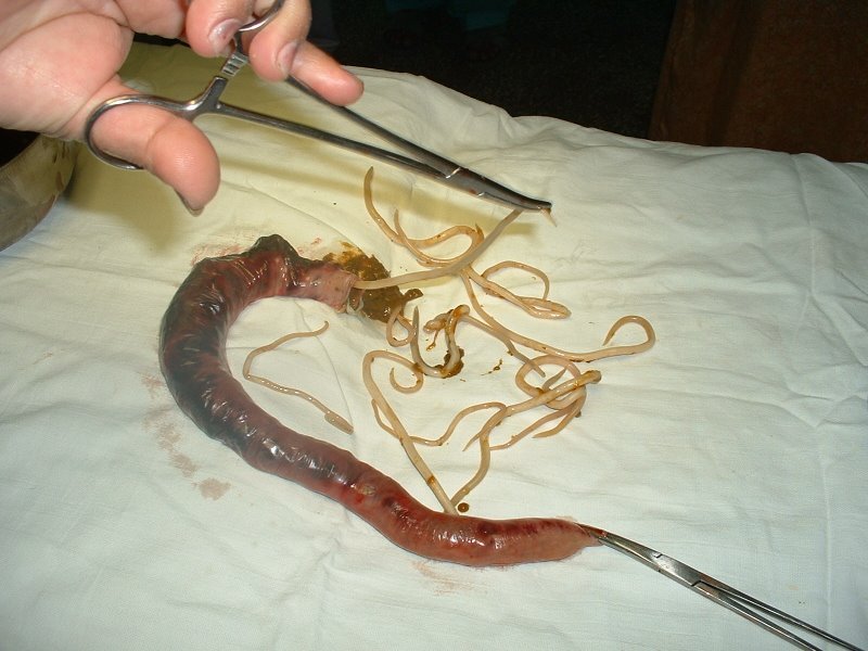 Ascaris lumbricoides 