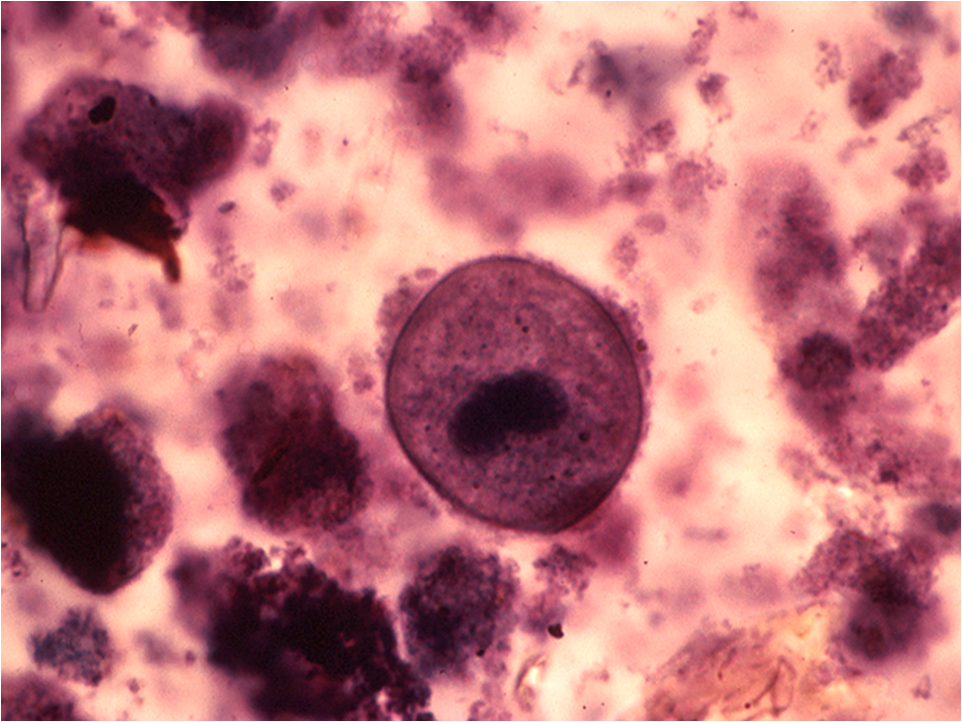 Balantidium coli