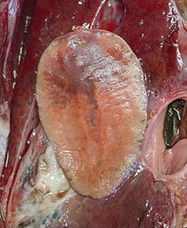 Opisthorchis felineus 