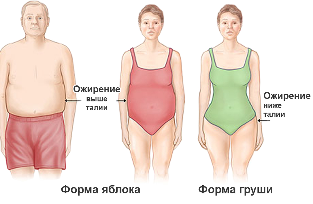 Cахарный диабет Cахарный диабет