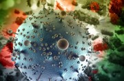 Организм способен на самостоятельную борьбу с ВИЧ