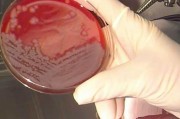 Летучие мыши помогли ученым продвинутся в противостоянии инфекциям Летучие мыши помогли ученым продвинутся в противостоянии инфекциям